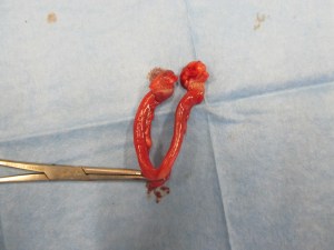 baarmoeder en eierstokken